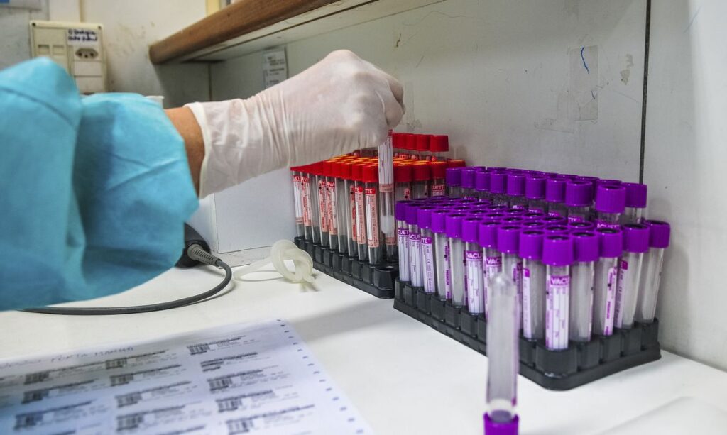 Ribeirão tem 455 novos casos de Covid-19 e total de doentes já ultrapassa 70 mil